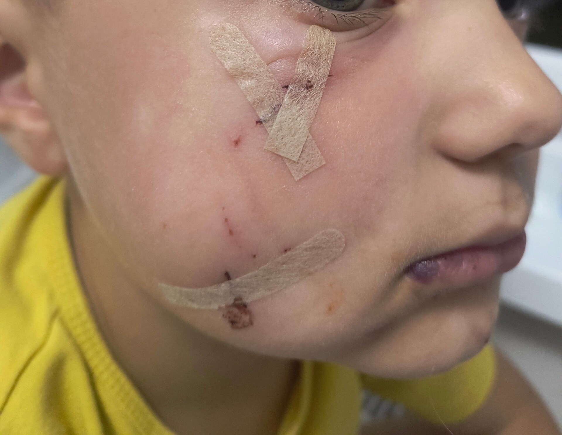 W Ustroniu pies pogryzł czterolatkowi twarz. Właściciel czworonoga uciekł, ale wysłał… anonim