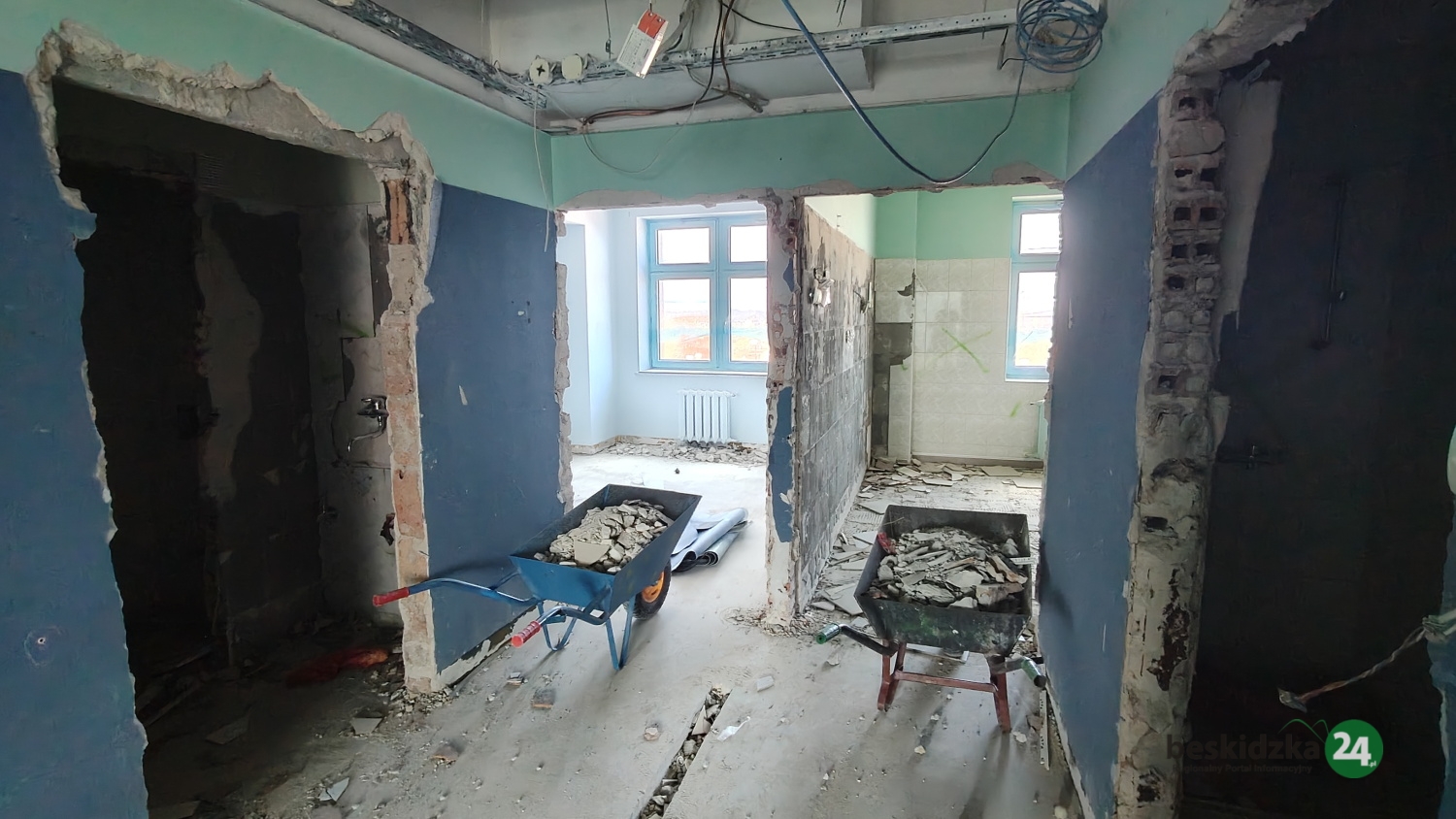 Technologiczna rewolucja na urologii w „Wojewódzkim”