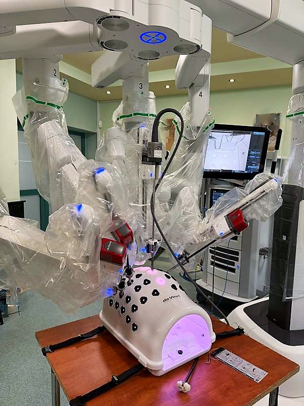 Najnowocześniejszy robot chirurgiczny systemu da Vinci w Szpitalu Wojewódzkim