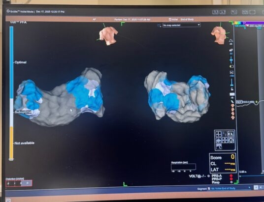 Innowacyjny system Volt już w Bielsku-Białej. Przełom w terapii arytmii