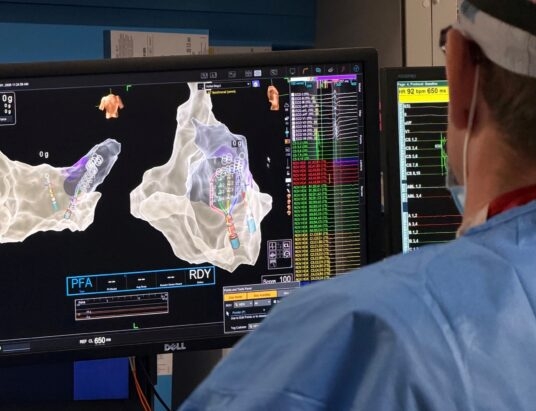 Najnowsza technologia ablacji dostępna dla szerszej grupy pacjentów